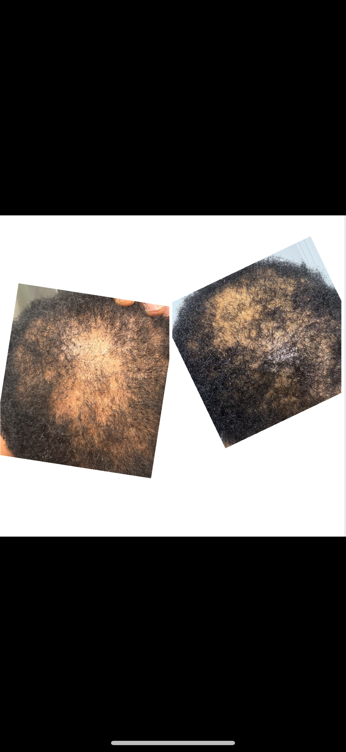 Stimulating Hair Growth Oil