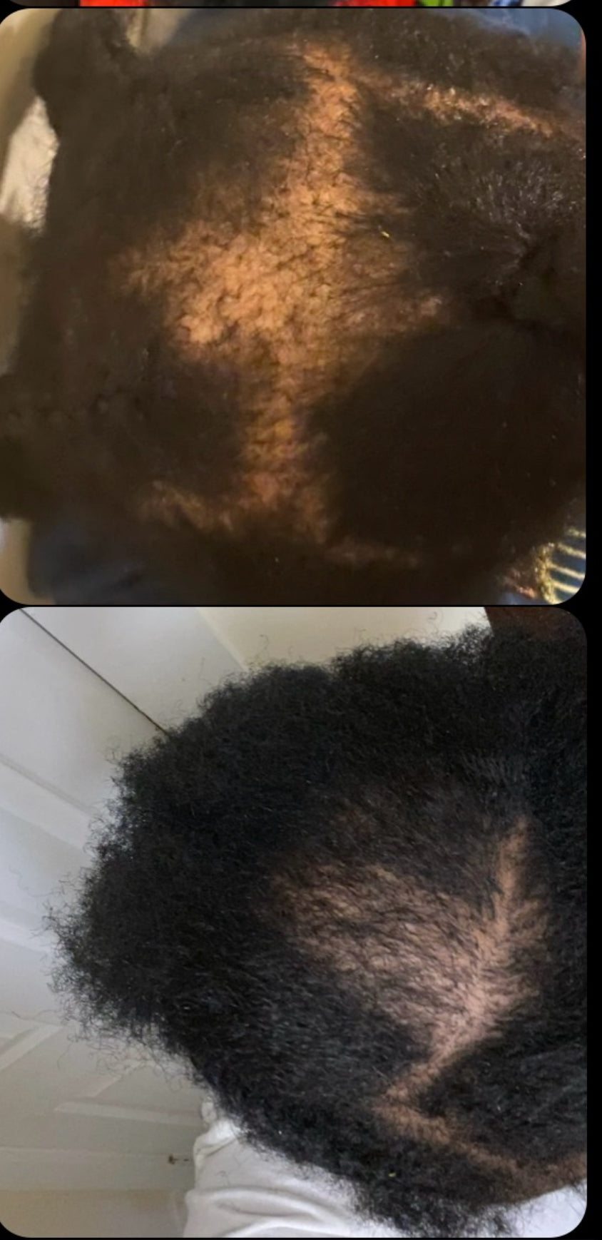A Couper Le Souffle Extra Strength Hair Growth Kit