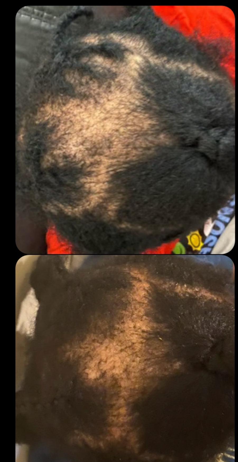 A Couper Le Souffle Extra Strength Hair Growth Kit