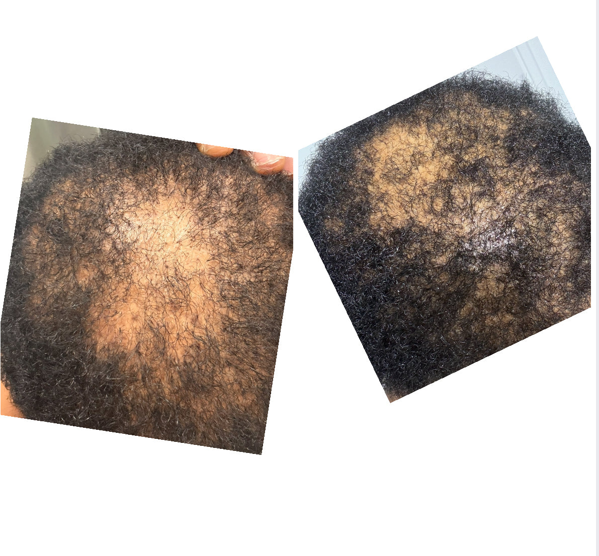 A Couper Le Souffle Extra Strength Hair Growth Kit