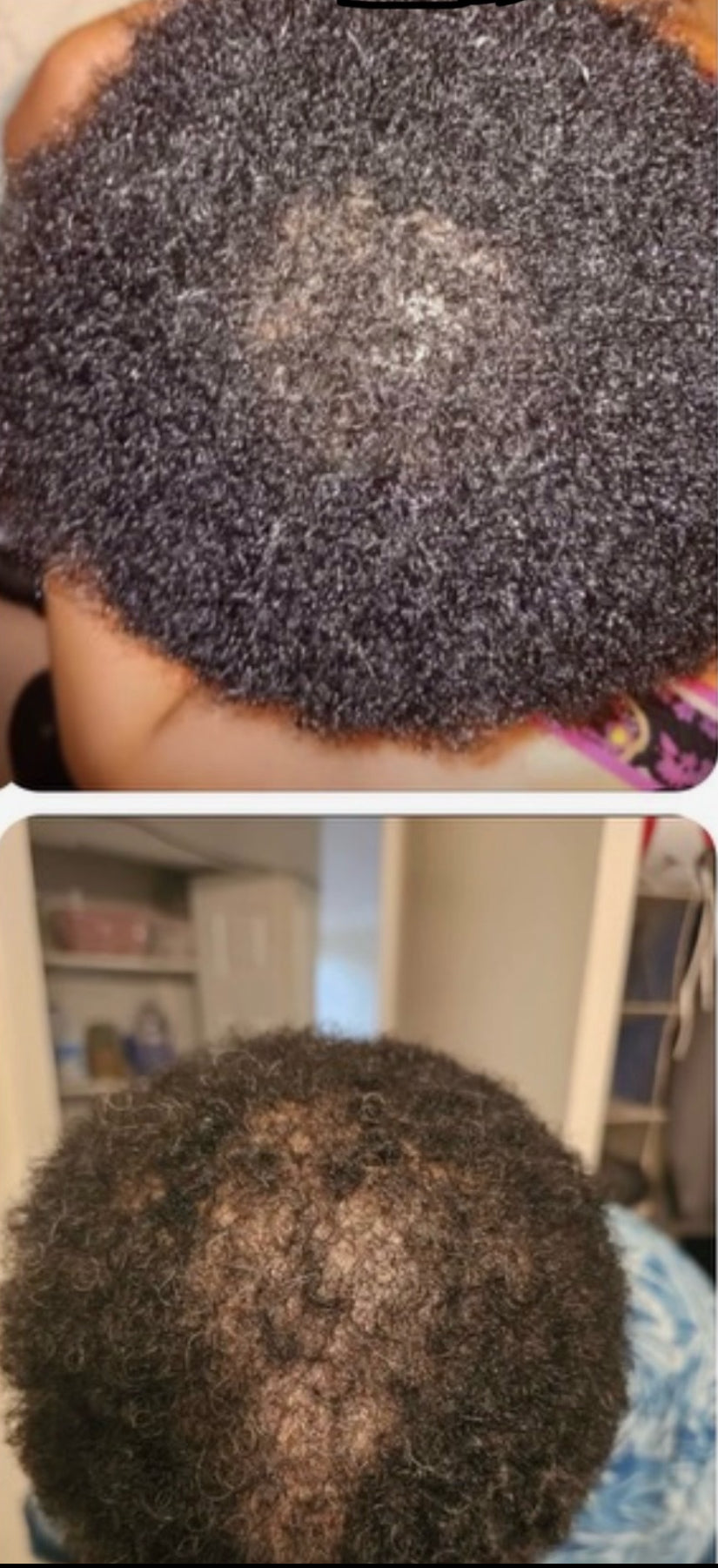 Stimulating Hair Growth Oil